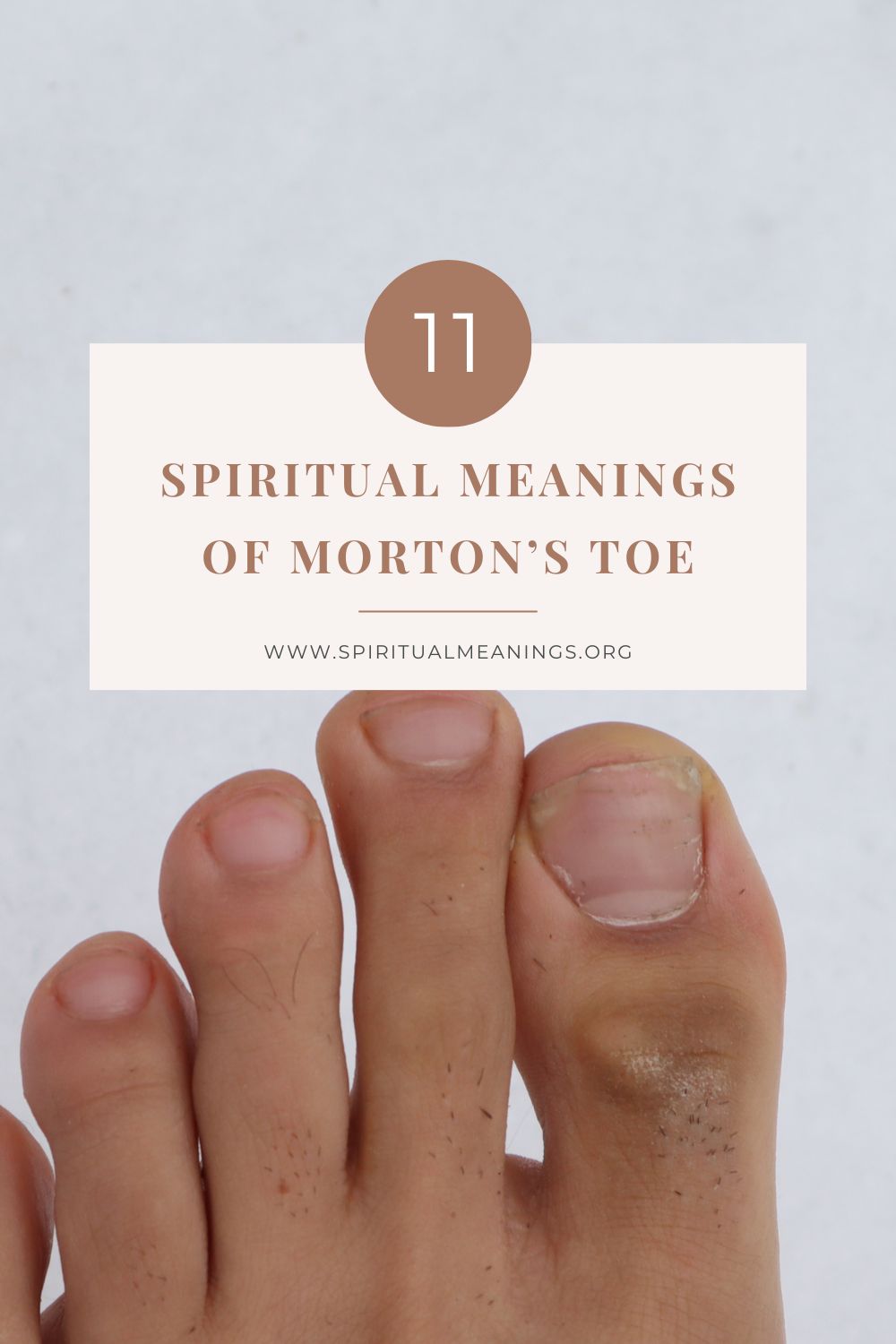 11 Spiritual Meanings of Morton’s Toe pin
